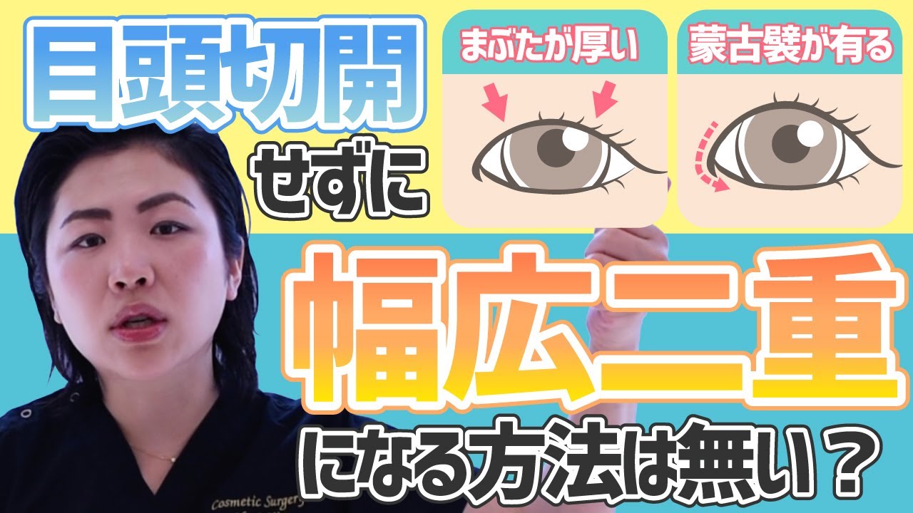 厚いまぶた 蒙古ひだ 目頭切開しないと 幅広二重 になれませんか ダウンタイムが取れない Youtube 厚いまぶた 蒙古ひだ 目頭切開しないと 幅広二重 になれませんか ダウンタイムが取れない Youtube