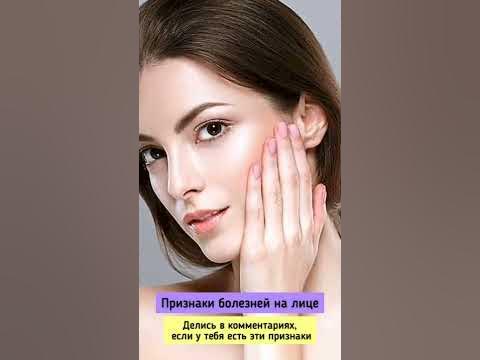 Признаки болезней на лице - YouTube