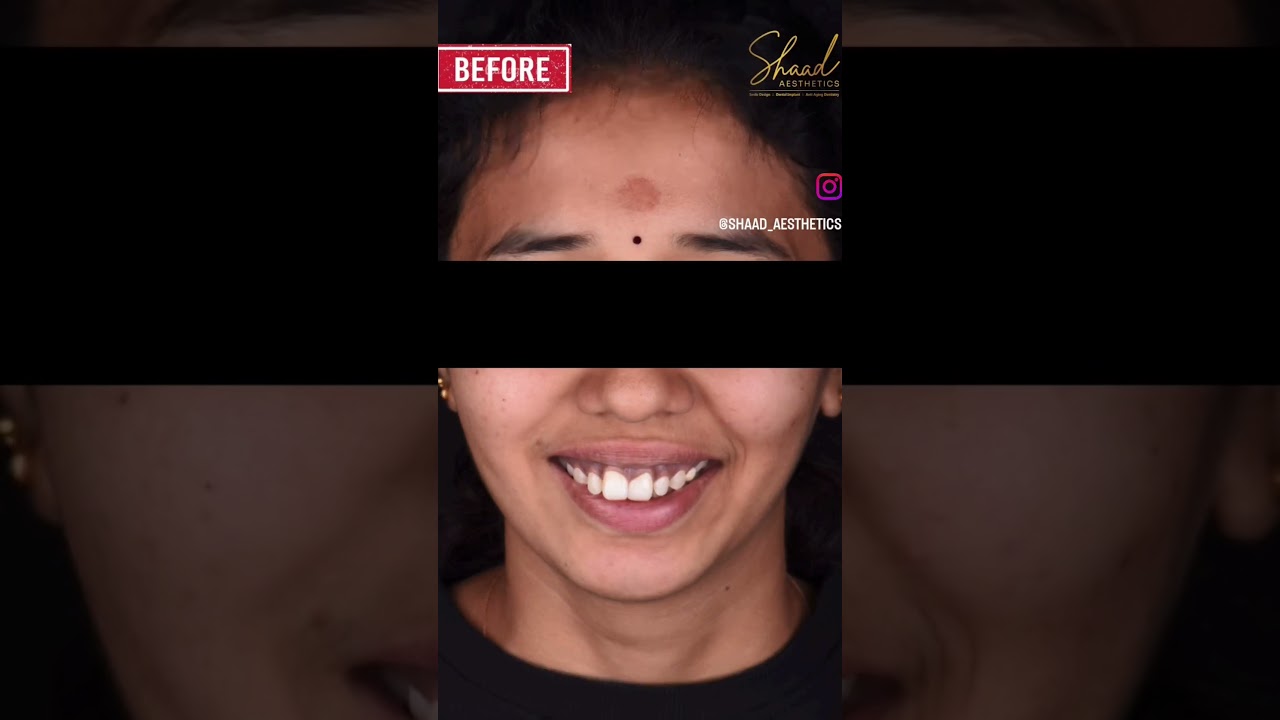 Best dental clinic in Coimbatore|Shaad Aesthetics|Dr Arshad|Smile correction treatment|Best dentist