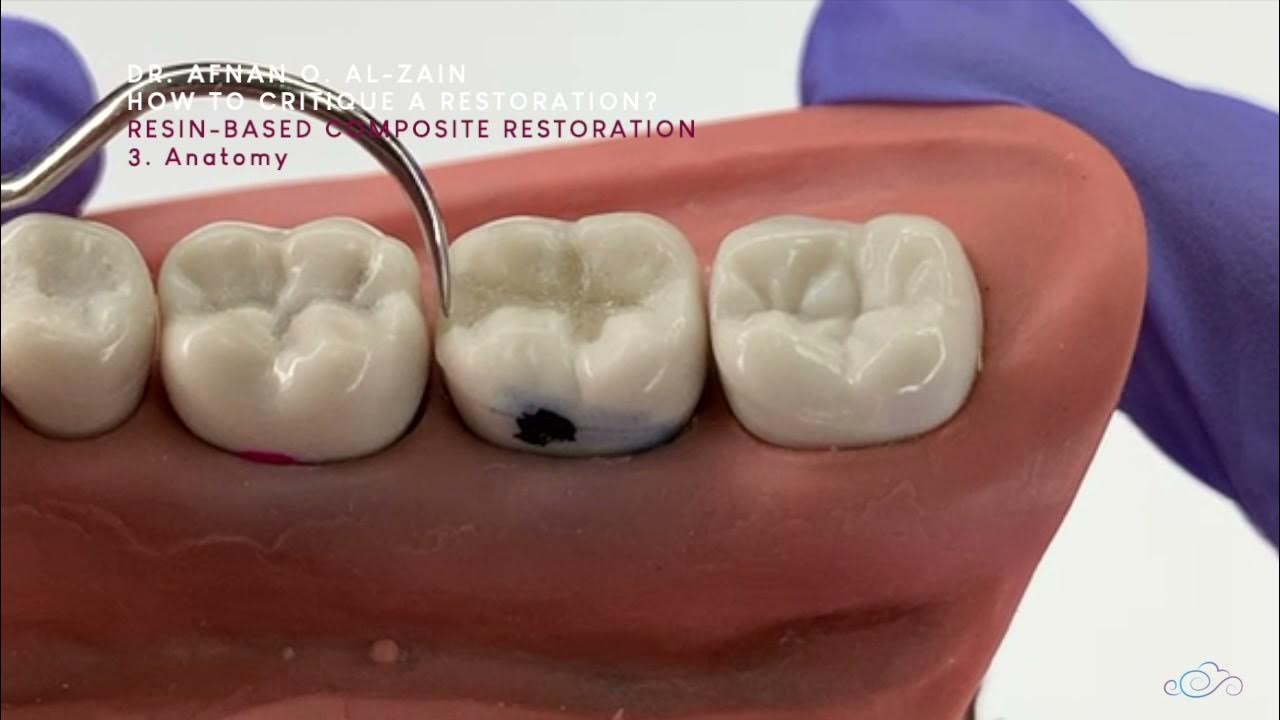 How to critique a restoration? Amalgam & Composite restorations Arabic عربي YouTube