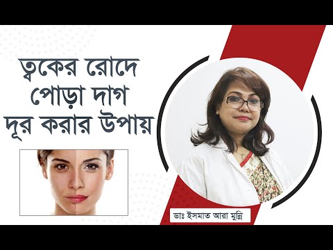 ভিডিও: রোদে পোড়া কি কপালের তাপমাত্রা পড়ার উপর প্রভাব ফেলবে?