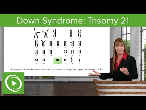 Video: Down Syndrome Analysis