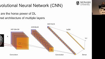 Deep learning approaches for MRI research: How it works by Dr Kamlesh Pawar