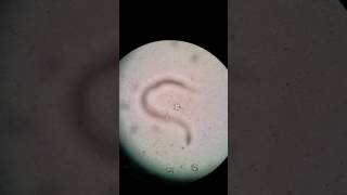 Hookworm(Ancyclostoma) Rhabditiform larvae Canine