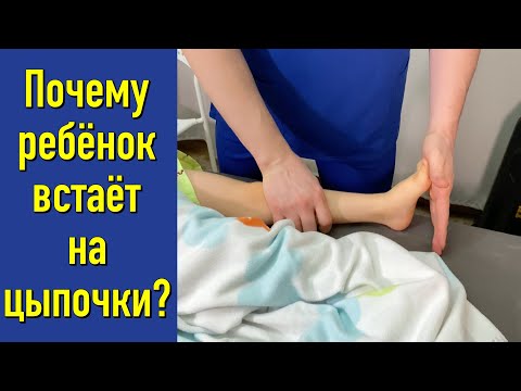 Почему ребёнок встаёт на цыпочки? Фролков С.В.    4K