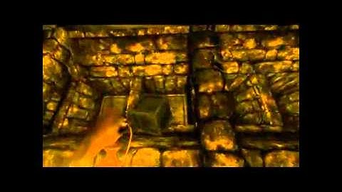 Amnesia 14 - Prison Ward Part II