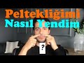 Peltekliği Nasıl Atlattım? | Hangi Kanalda Çalışıyorum?