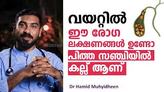 വയറ്റിൽ ഈ രോഗ ലക്ഷണങ്ങൾ ഉണ്ടോ പിത്ത സഞ്ചിയിൽ കല്ല് ആണ് സൂക്ഷിക്കുക | Understanding Gallstones