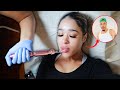 I Got Lip "Fillers" To See How My Fiance Reacts! *BOTCHED*