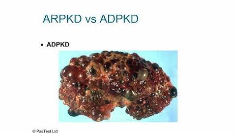 MRCPCH lecture nephrology 1