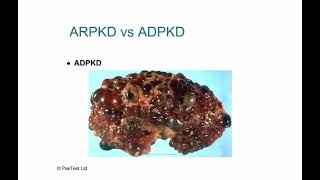 MRCPCH lecture nephrology 1