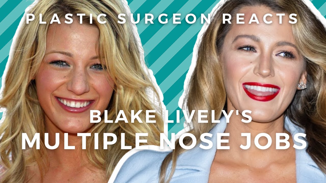 Blake Lively Plastic Surgery: Plastic Surgeon Reacts to Gossip Girl Nose Jobs