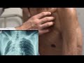 Respiratory system Examination 