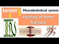 2h Healing Of A Bone Fracture التئام كسر العظام 