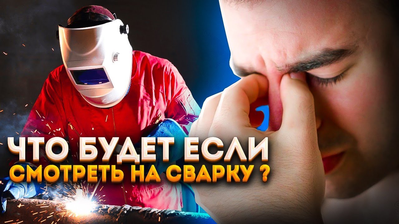 Что будет если смотреть на сварку без защитных очков?