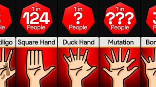 Comparison: Weird Types of Hands