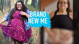 I've Never Revealed My Excess Skin  Until Now | BRAND NEW ME