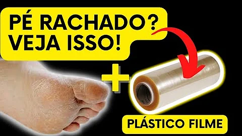 O que causa ressecamento nos pés e mãos?