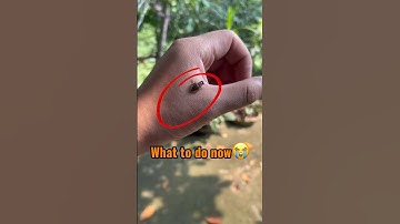 What to do now😭😭 #beesting #bees #beekeeping #queenbee