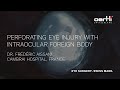 Surgery perforating eye injury with intraocular foreign body by frdric aissani