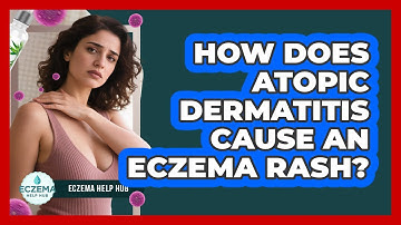 How Does Atopic Dermatitis Cause An Eczema Rash? - Eczema Help Hub