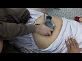 Hepatitis treatment in pakistan  jangli kabootar sy hepatitis ka elaj