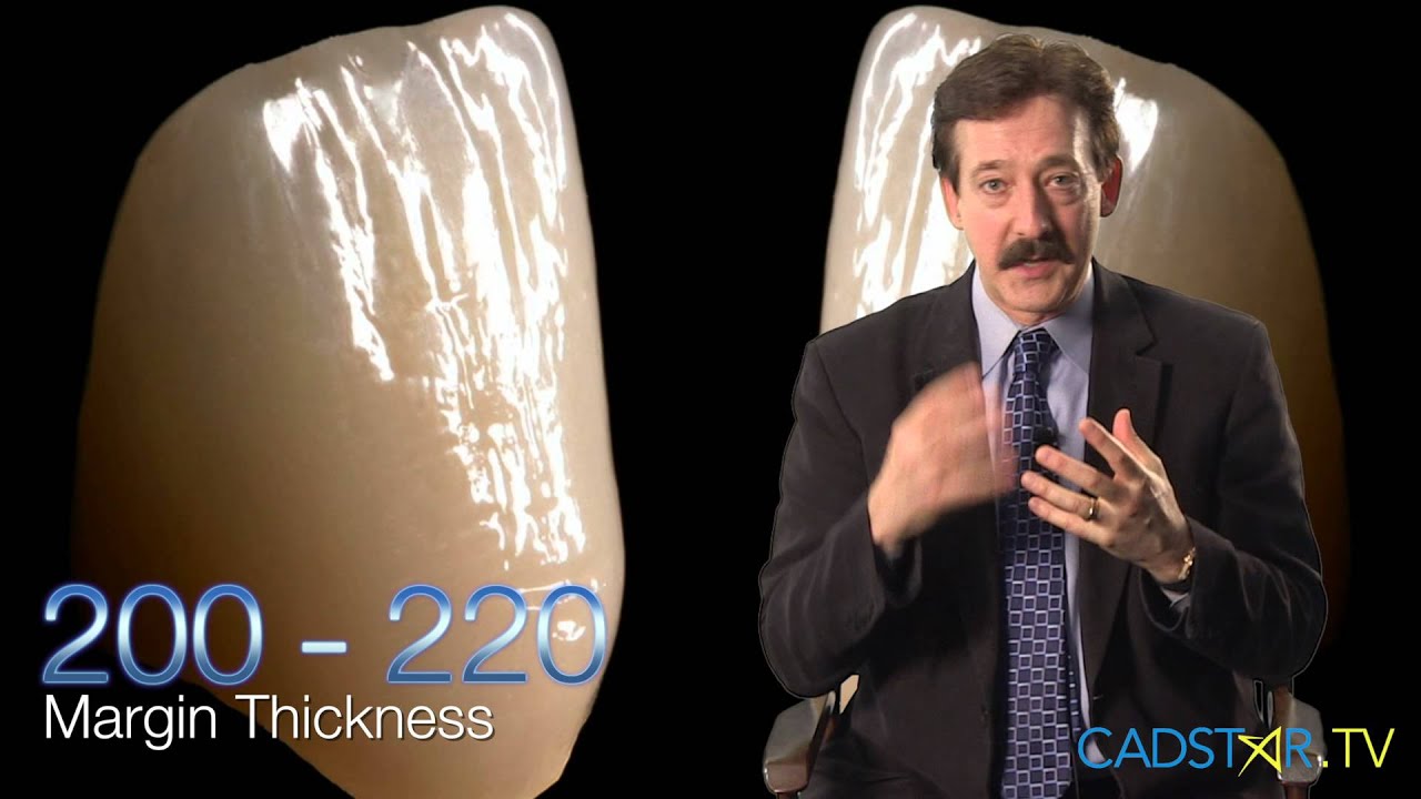 CEREC Omnicam & Bluecam Parameter - Margin Thickness