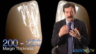Cerec Omnicam & Bluecam Parameter - Margin Thickness