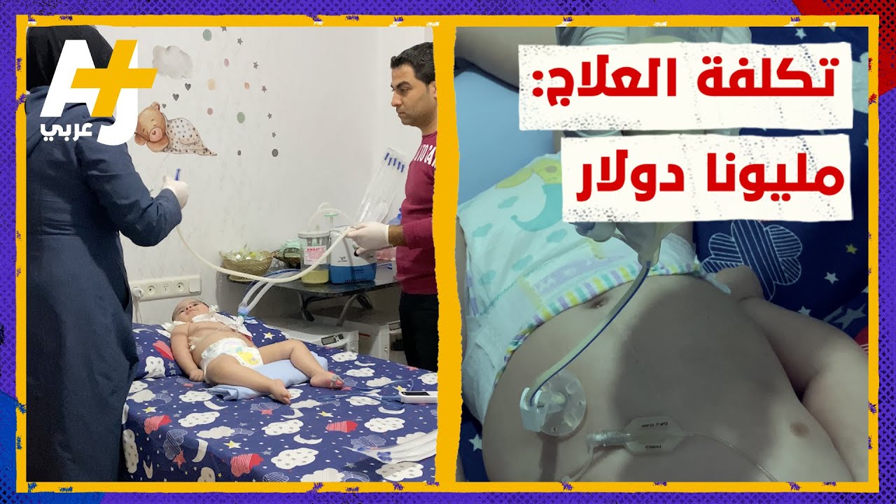حياة هذا الطفل تحتاج مليوني دولار أمريكي لإنقاذها