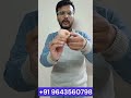 Child Congenital Anomaly Resolved I Silicone Thumb for the Baby I Cosmetic Restoration +919643560798