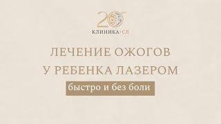 Лечение ожогов у ребёнка лазером, БЫСТРО И БЕЗ БОЛИ