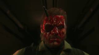 Metal Gear Solid V: The Phantom Pain - The Aftermath of the Outbreak