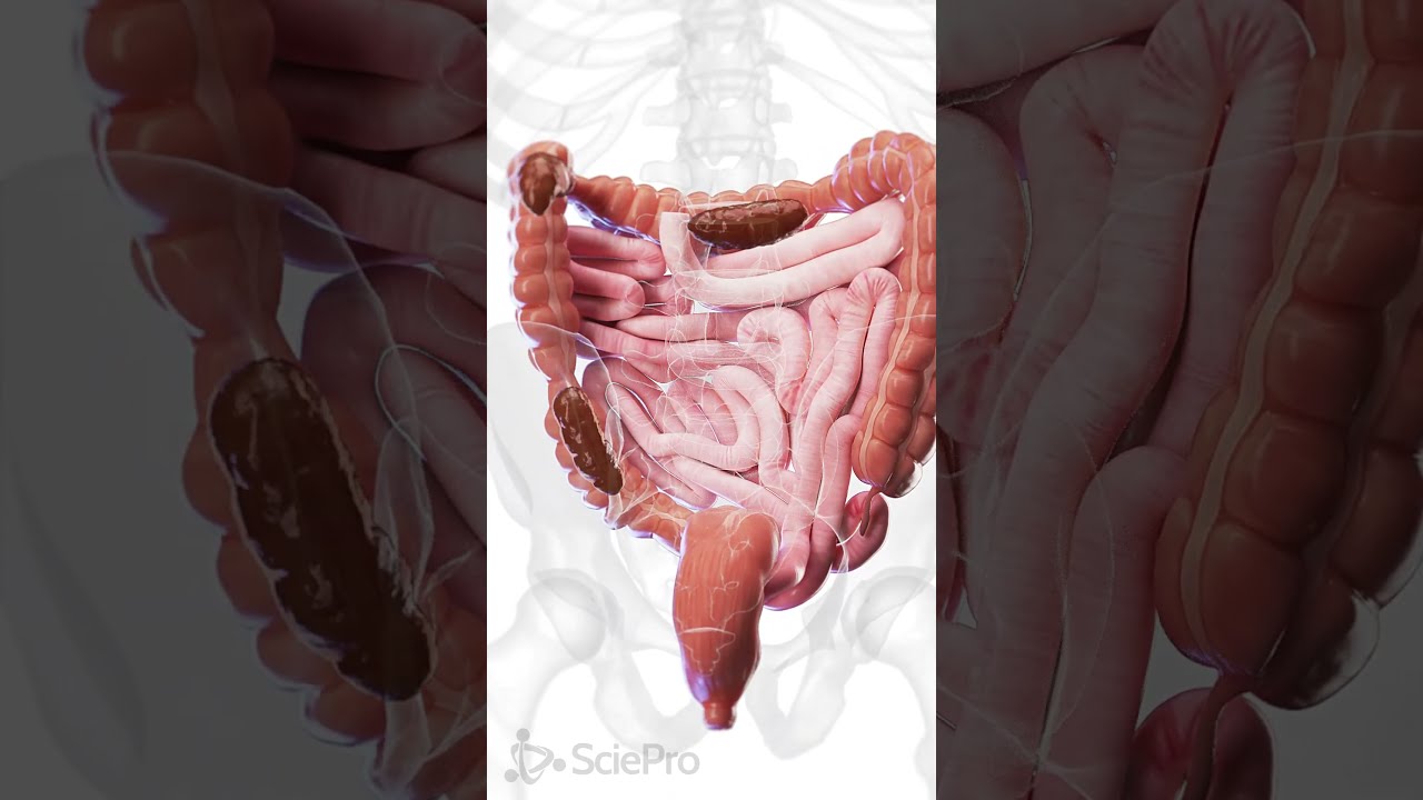  Understanding Constipation A Closer Look At The Colon Anatomy