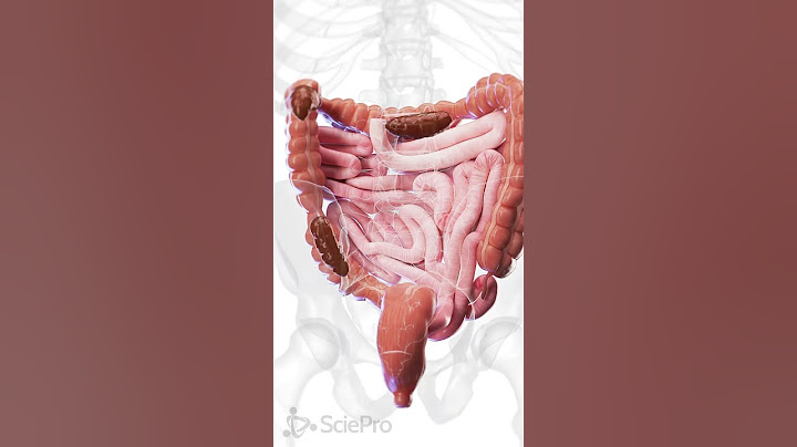 🚨 Understanding Constipation: A Closer Look at the Colon 🚨 #anatomy