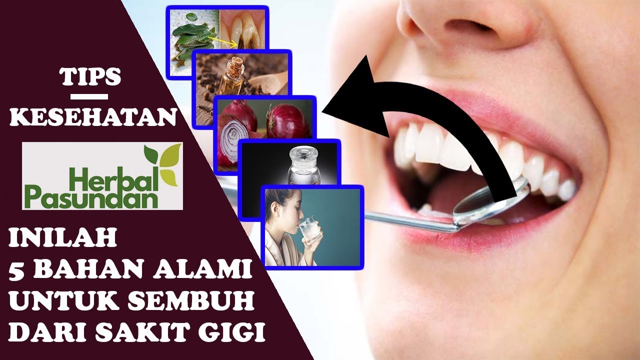 BEGINILAH CARA PENGOBATAN SAKIT GIGI DENGAN BAHAN ALAMI - YouTube