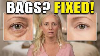 Under Eye Bags: Stop Wasting Your Money on the Wrong Products