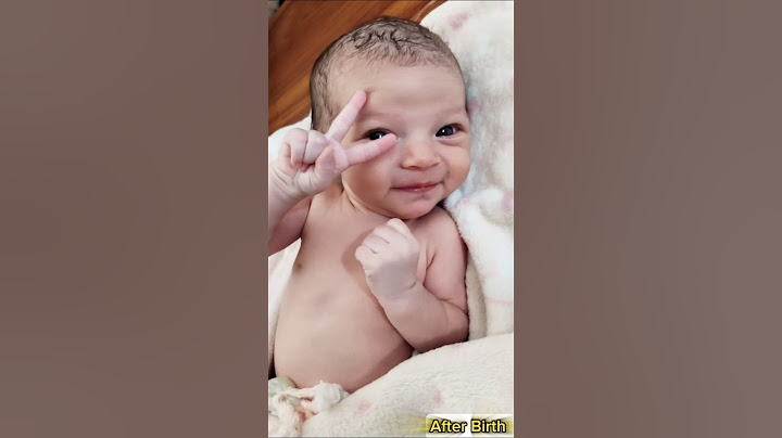 Wonderful Reaction and Cute Smile of Beautiful Newborn Baby @AfterBirth