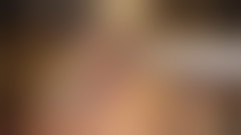 Laparoscopic complete mesocolic excision CME for right colon cancer