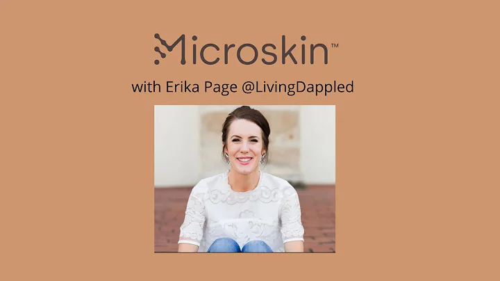 ERIKA PAGE DISCUSSES LIVING WITH UNIVERSAL VITILIG...