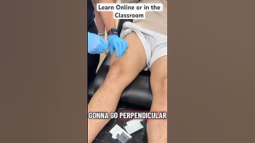 Dry Needling the Quads ⚡ Watch the Twitch Response!
