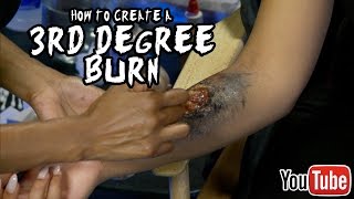 3rd Degree Burn Make Up Tutorial