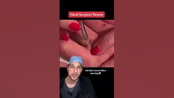 We got a gopher! #Screw #Nail #Finger #Tweezers #Surgery #Nurse #Medical #MedicalStudent #Dr