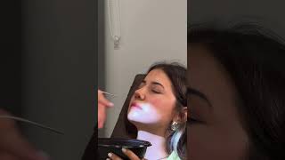 Nose splints removal #rhinoplastyturkey #fyp #fypシ゚viral#nosejobbeforeandafter #nose  #nosesplint