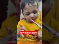 Tilted Baby Head? 🤔 Fix it with Dr. Vivekanand#baby #viral #doctor #viralvideo #viralreels #Patna