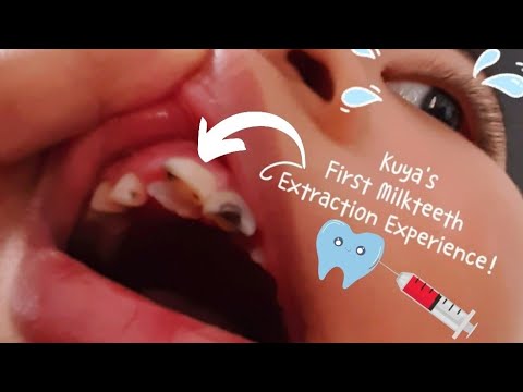 वीडियो: दंत चिकित्सक के पास अपने बच्चे की नियोजित यात्राओं को ठीक से कैसे व्यवस्थित करें