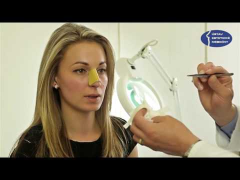 Video: Špatný Zápach V Nose: Příčiny, Léčba A Preventivní Opatření
