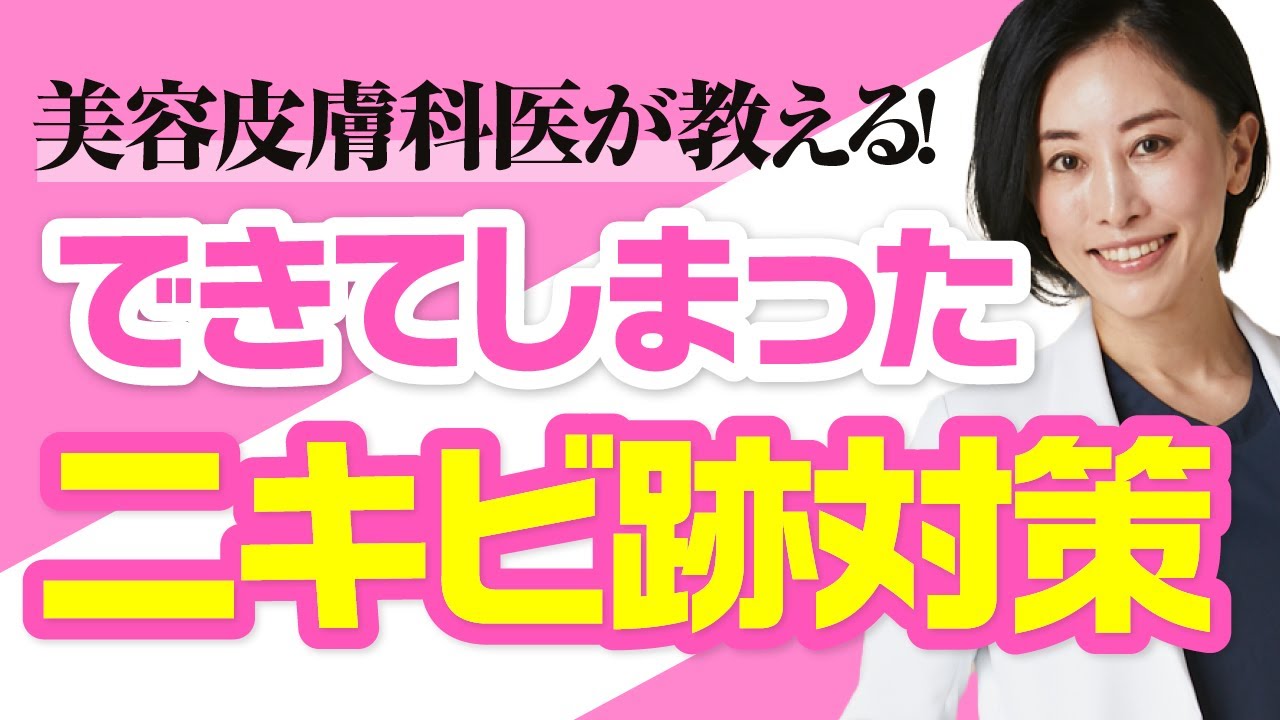 《美容皮膚科医が教える！》できてしまったニキビ跡対策