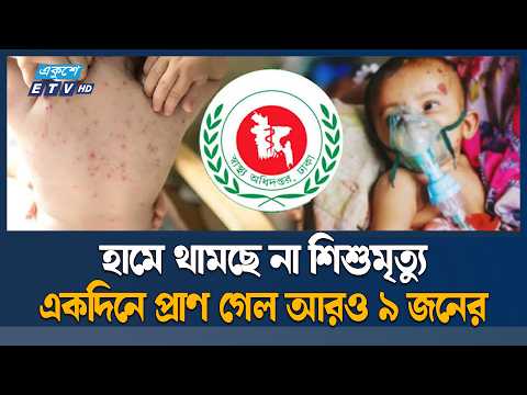 হাম উপসর্গে একদিনে আরও ৯ শিশুর মৃ/ত্যু, আক্রান্ত ১৩৪১ | Measles | ETV News