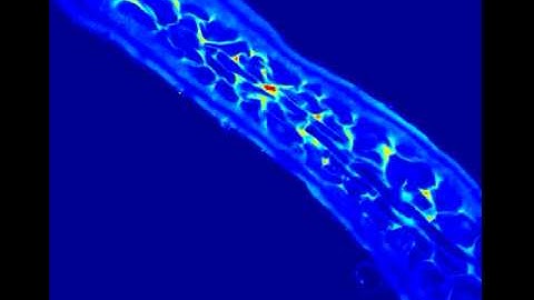 Growth of a Radicle (First Root)