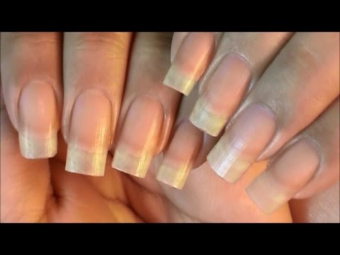Peeling Nails Treatment & Prevention - YouTube